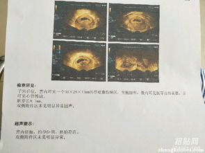 香港驗(yàn)血結(jié)果16項(xiàng)n(香港驗(yàn)血查dna結(jié)果單子怎么看 ) 