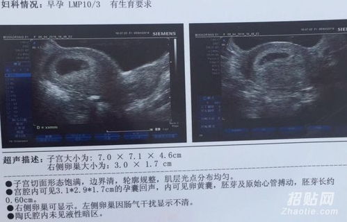 香港驗血電話鑒定(香港現代醫學?？乞炑b定y染色體電話是