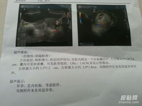 香港驗血要再次查血(有懂的辣媽進來說說,香港驗血什么情況