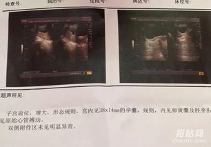 香港驗血查男女被騙了(央視香港驗性別騙局,香港驗血是不是