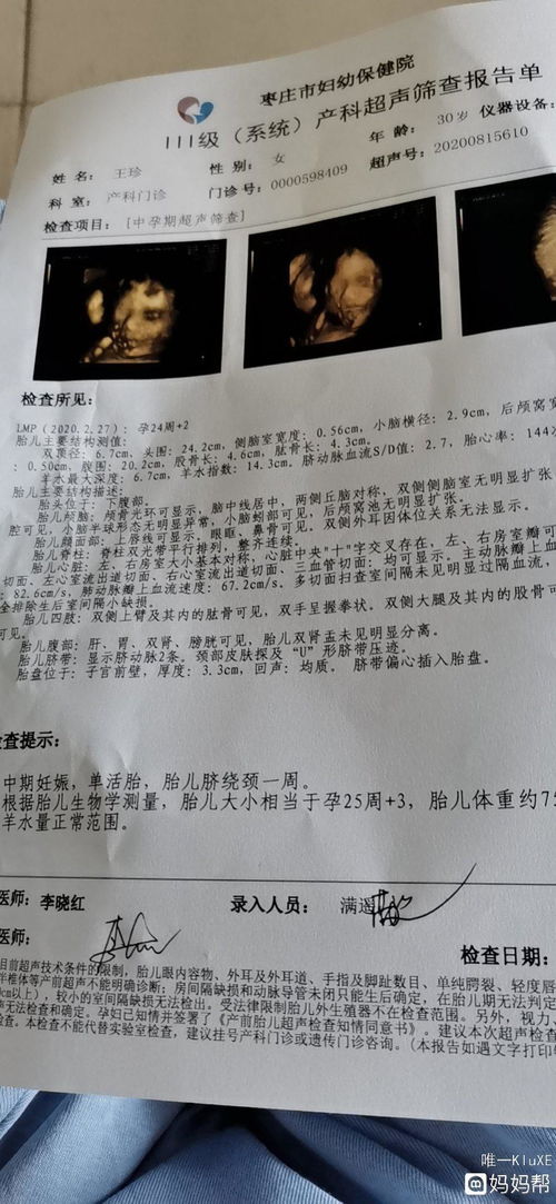 香港男寶女寶驗血區別在哪(驗血生男生女準確率) 