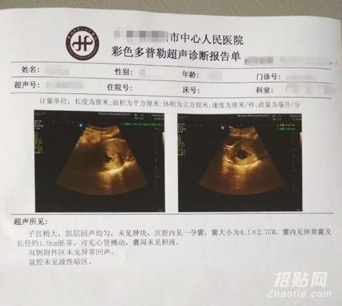 香港驗血測性別準不準確(香港驗?zāi)信硎鞘裁?準確嗎) 