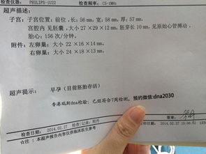 香港驗血雙胞胎有誤差(點樣可以知道生仔定生女啊 ) 