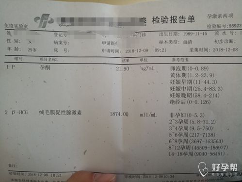 香港驗血吃孕酮會影響(關于產檢假,孕媽媽有哪些需要知道的