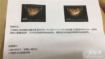 香港醫院預約七周驗血xy要求(香港驗血鑒定男女準嗎) 