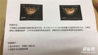 香港驗血前一年流產婚能驗(3個月前人流了還能去香港驗血查