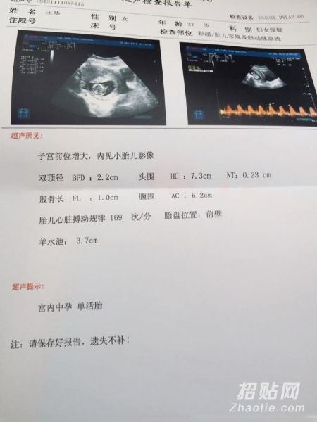 香港不準的驗血機構(香港裕博生物科技有限公司驗血準確嗎)