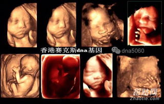 香港驗(yàn)血男女去哪里查(香港驗(yàn)血驗(yàn)?zāi)信趺打?yàn)的,安全嗎 ) 