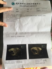 試管單胎到香港驗血(香港驗血寄血液樣本如何寄 驗血郵寄流