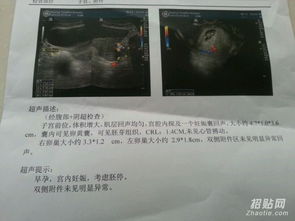 香港驗血孕周大了還能驗嗎(懷孕11周了去香港驗血查性別還) 