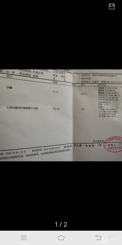 香港驗血孕酮低會影響嗎(懷男寶是什么感覺 ) 