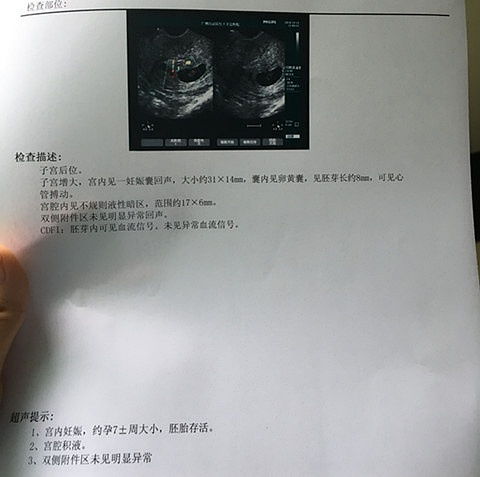香港dna東道主驗血檢測男女(我想預約香港醫院驗血看一下寶,