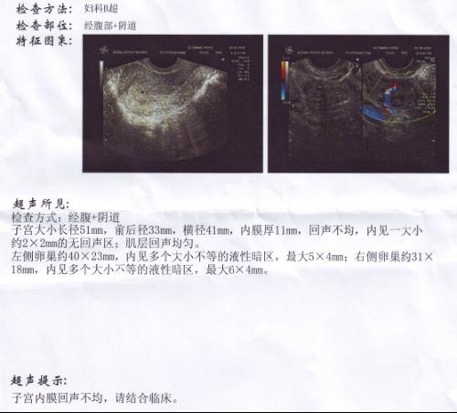 B超和香港驗血一樣還會翻盤嗎(B超鑒定性別翻盤的幾率有嗎 )