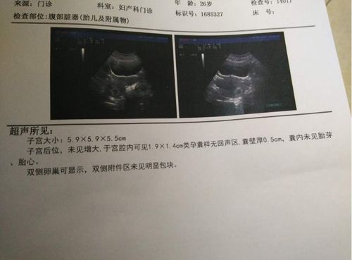 胎芽沒到10mm香港驗血準嘛(香港驗血胎芽一定要10mm嗎,如果滿7