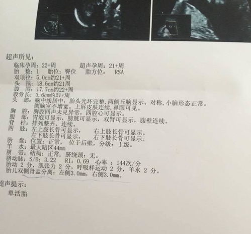 香港驗血需要b超單7周(香港驗血要懷孕多少周才可以去) 