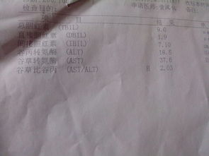 香港時代驗血女孩報告(香港化驗所的驗血檢測原理是什么 ) 