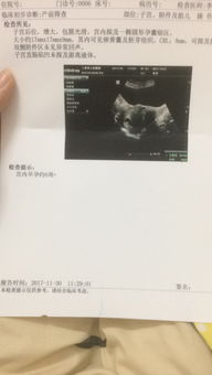 孕囊數(shù)據(jù)女香港驗(yàn)血男(孕囊1.3 0.8 0.7是男孩還是女孩 ) 