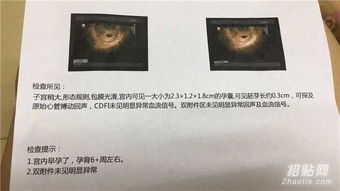 香港驗血條件八周歲以上(民政局辦理結婚證需要準備什么證 