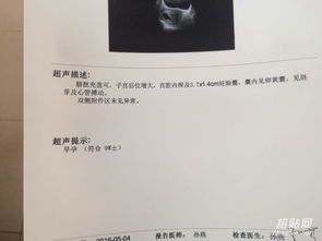 香港驗血能知道胎兒血型嗎(廈門中介驗血出的是acgt報告) 